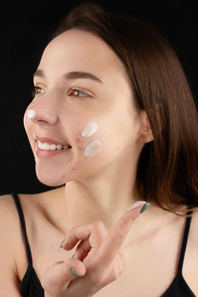 Facials in Glasgow, Scotland. This image features a lady with some skin issues. 