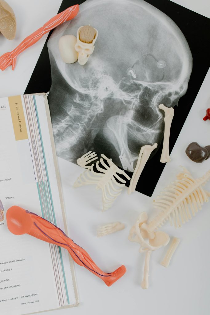 Massage Therapy in Glasgow. This image features some skeleton toy bones and a x-ray.